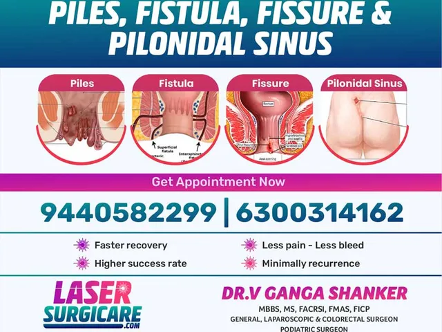 Laser Surgicare advanced laser treatments flyer — piles, fistula, fissure, pilonidal sinus
